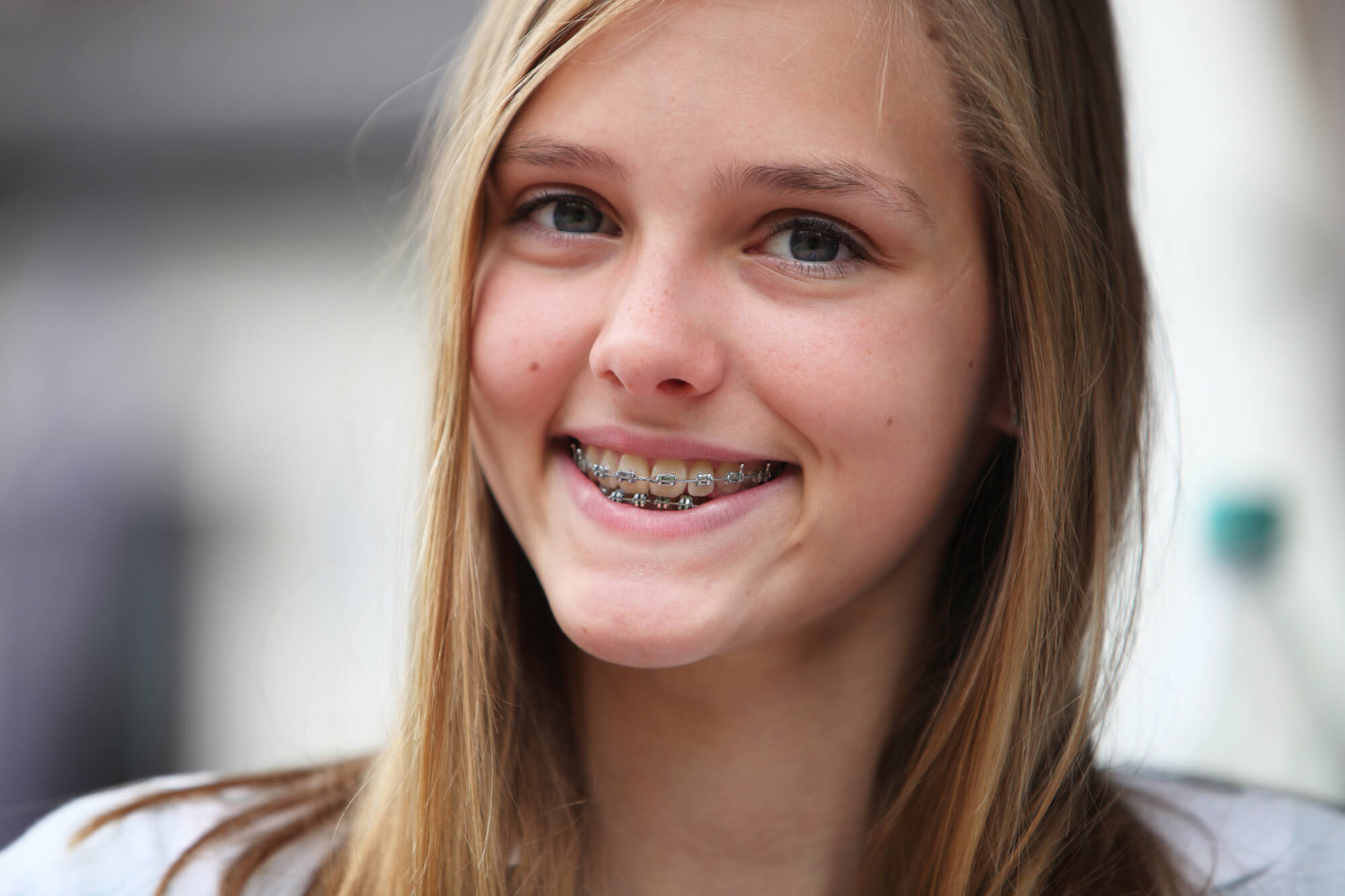 teenage girl with Affordable Orthodontics in Woodland Hills.