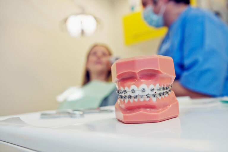 model of teeth with braces at the back of the Best Orthodontist Woodland Hills 